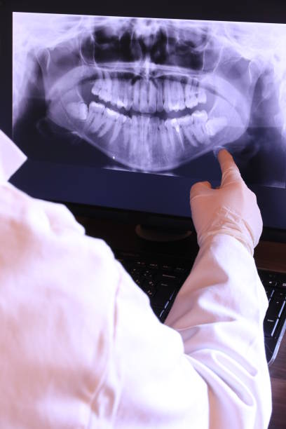 Best Walk-In Emergency Dentist in Staples, CT